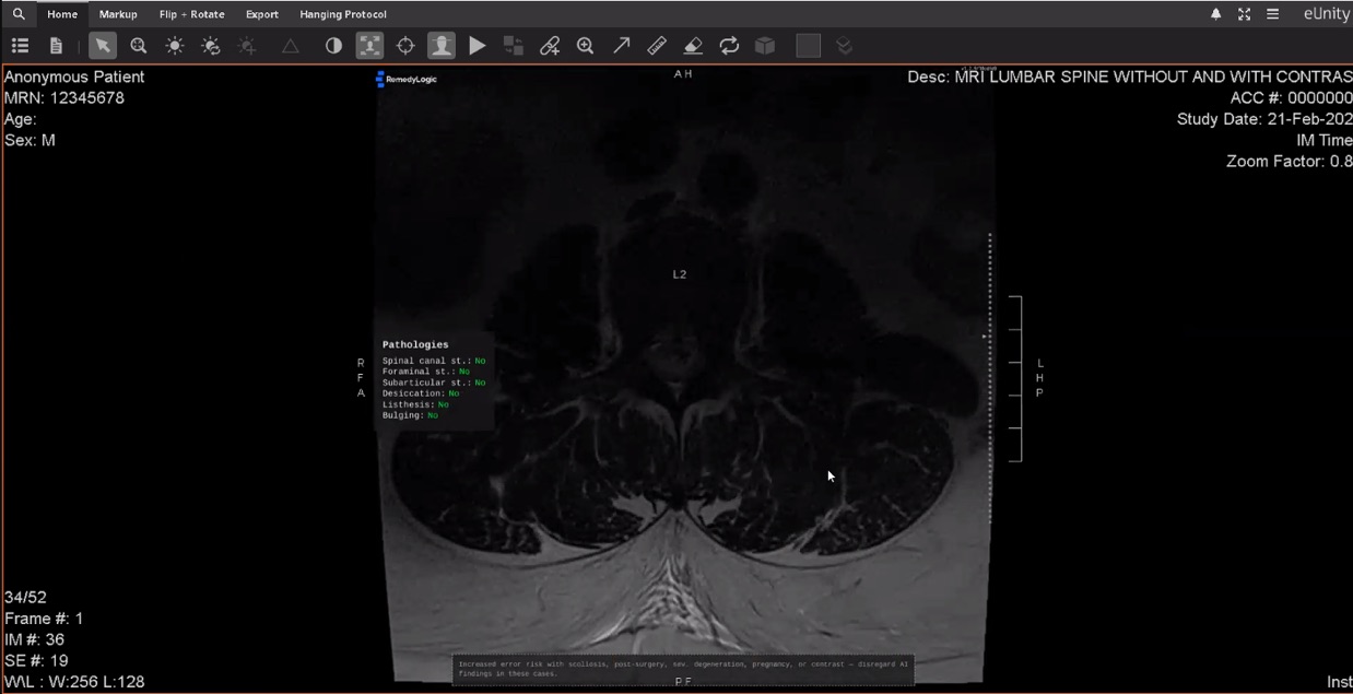 The overlay shown inside the eUnity diagnostic viewer, the vendor's own interface around it