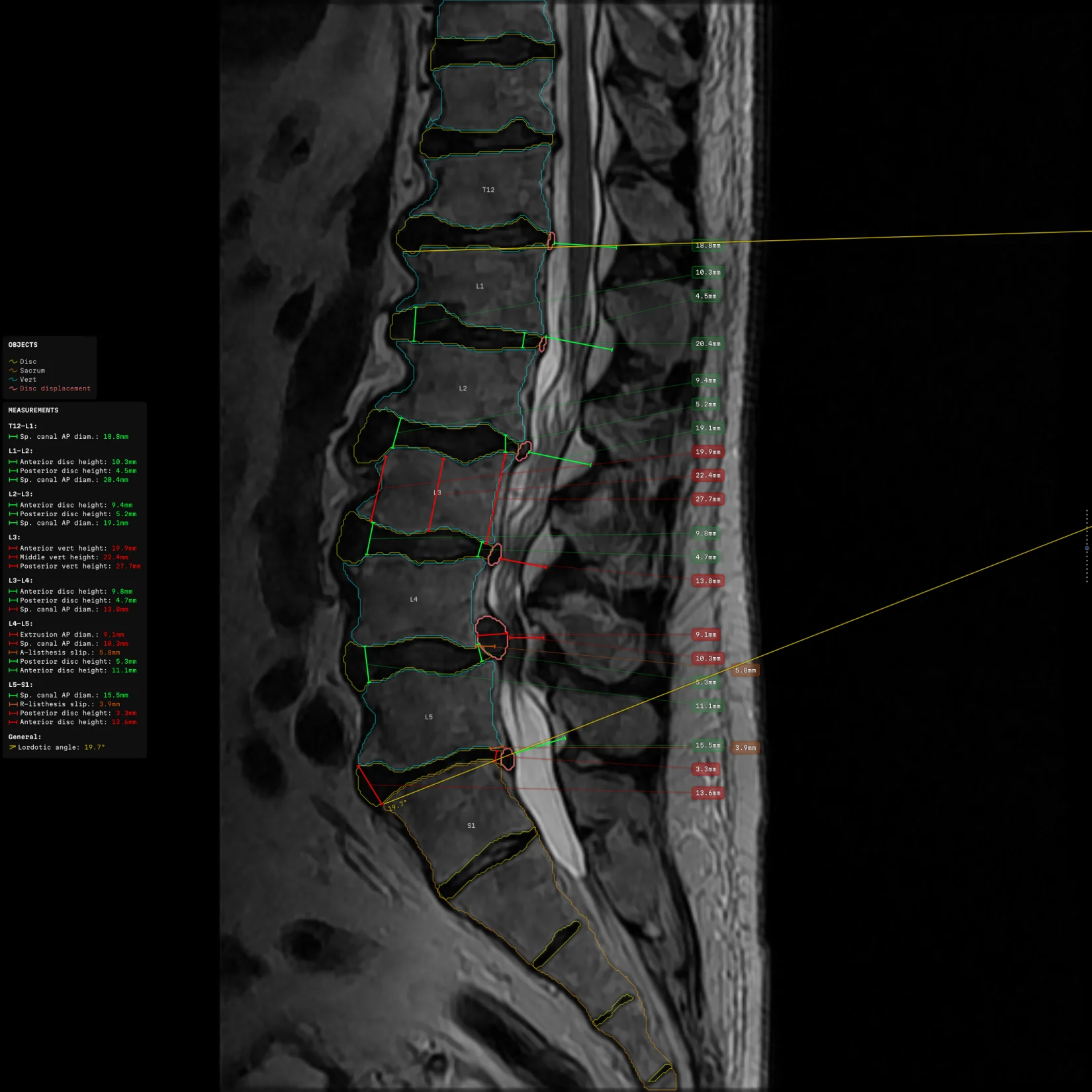 the same slice magnified twice, the anatomy twice the size and the labels unchanged, the column re-seated
