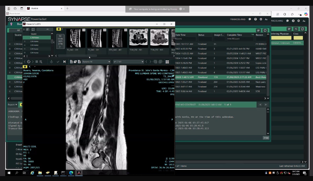 the series list of a study in Fujifilm Synapse, the enriched series standing among the ones the scanner produced