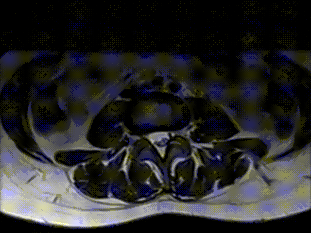 Radiology MRI Viewer